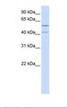 LRPB7 / LRRC23 Antibody - 721_B cell lysate. Antibody concentration: 1.0 ug/ml. Gel concentration: 12%.  This image was taken for the unconjugated form of this product. Other forms have not been tested.