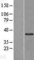 LRPB7 / LRRC23 Protein - Western validation with an anti-DDK antibody * L: Control HEK293 lysate R: Over-expression lysate