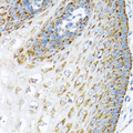 LRPPRC Antibody - Immunohistochemistry of paraffin-embedded human esophagus.