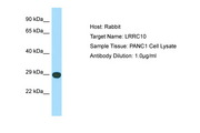 LRRC10 Antibody -  This image was taken for the unconjugated form of this product. Other forms have not been tested.