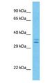 LRRC10B Antibody - LRRC10B antibody Western Blot of HeLa. Antibody dilution: 1 ug/ml.  This image was taken for the unconjugated form of this product. Other forms have not been tested.