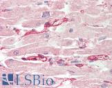 LRRC14 Antibody - Human, Heart: Formalin-Fixed Paraffin-Embedded (FFPE).  This image was taken for the unconjugated form of this product. Other forms have not been tested.