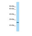 LRRC14 Antibody - Western blot of Mouse Testis. Lrrc14 antibody dilution 1.0 ug/ml.  This image was taken for the unconjugated form of this product. Other forms have not been tested.