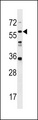 LRRC14B Antibody - LRRC14B Antibody western blot of WiDr cell line lysates (35 ug/lane). The LRRC14B antibody detected the LRRC14B protein (arrow).