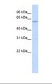 LRRC15 Antibody - Hela cell lysate. Antibody concentration: 1.0 ug/ml. Gel concentration: 12%.  This image was taken for the unconjugated form of this product. Other forms have not been tested.