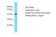 LRRC19 Antibody -  This image was taken for the unconjugated form of this product. Other forms have not been tested.