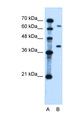 LRRC26 Antibody - LRRC26 antibody ARP44660_P050-NP_001013675-LRRC26  Antibody Western blot of Jurkat lysate.  This image was taken for the unconjugated form of this product. Other forms have not been tested.