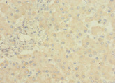 LRRC31 Antibody - Immunohistochemistry of paraffin-embedded human liver tissue using LRRC31 Antibody at dilution of 1:100