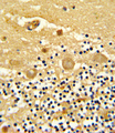 LRRC32 Antibody - Formalin-fixed and paraffin-embedded human cerebellum reacted with GARP Antibody , which was peroxidase-conjugated to the secondary antibody, followed by DAB staining. This data demonstrates the use of this antibody for immunohistochemistry; clinical relevance has not been evaluated.