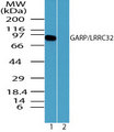 LRRC32 Antibody - Western blot of GARP/LRRC32 in mouse thymus lysate in the 1) absence and 2) presence of immunizing peptide using Polyclonal Antibody to GARP/LRRC32 at 0.5 ug/ml. Goat anti-rabbit Ig HRP secondary antibody, and PicoTect ECL substrate solution, were used for this test.