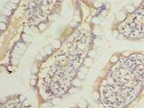LRRC39 Antibody - Immunohistochemistry of paraffin-embedded human small intestine tissue using antibody at dilution of 1:100.
