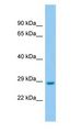 LRRC3B Antibody - LRRC3B antibody Western Blot of Rat Pancreas.  This image was taken for the unconjugated form of this product. Other forms have not been tested.