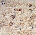 LRRC4 Antibody - Formalin-fixed and paraffin-embedded human brain tissue reacted with LRRC4 Antibody , which was peroxidase-conjugated to the secondary antibody, followed by DAB staining. This data demonstrates the use of this antibody for immunohistochemistry; clinical relevance has not been evaluated.
