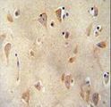 LRRC40 Antibody - LRC40 antibody immunohistochemistry of formalin-fixed and paraffin-embedded human brain tissue followed by peroxidase-conjugated secondary antibody and DAB staining.
