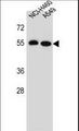 LRRC6 Antibody - LRRC6 Antibody western blot of NCI-H460,A549 cell line lysates (35 ug/lane). The LRRC6 antibody detected the LRRC6 protein (arrow).