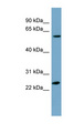 LRRC6 Antibody - LRRC6 antibody Western blot of PANC1 cell lysate. This image was taken for the unconjugated form of this product. Other forms have not been tested.