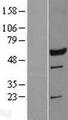 LRRC6 Protein - Western validation with an anti-DDK antibody * L: Control HEK293 lysate R: Over-expression lysate