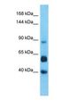 LRRC66 Antibody - Western blot of LRC66 Antibody with human Liver Tumor lysate.  This image was taken for the unconjugated form of this product. Other forms have not been tested.