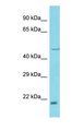 LRRC75A / C17orf76 Antibody - Western blot of FAM211A Antibody with human 721_B Whole Cell lysate.  This image was taken for the unconjugated form of this product. Other forms have not been tested.