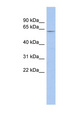 LRRTM1 Antibody - LRRTM1 antibody Western blot of Fetal Muscle lysate. This image was taken for the unconjugated form of this product. Other forms have not been tested.