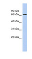 LRRTM4 Antibody - LRRTM4 antibody Western blot of OVCAR-3 cell lysate. This image was taken for the unconjugated form of this product. Other forms have not been tested.