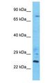 LSG1 Antibody - LSG1 antibody Western Blot of ACHN. Antibody dilution: 1 ug/ml.  This image was taken for the unconjugated form of this product. Other forms have not been tested.