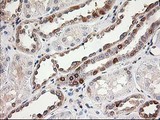 LSM1 Antibody - IHC of paraffin-embedded Human Kidney tissue using anti-LSM1 mouse monoclonal antibody.