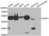 LSM11 Antibody - Western blot analysis of extracts of various cell lines.