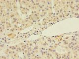 LSM4 Antibody - Immunohistochemistry of paraffin-embedded human adrenal gland using antibody at 1:100 dilution.  This image was taken for the unconjugated form of this product. Other forms have not been tested.