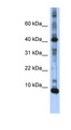 LSM6 Antibody - LSM6 antibody Western blot of Transfected 293T cell lysate. This image was taken for the unconjugated form of this product. Other forms have not been tested.