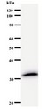 LSM8 / NAA38 Antibody - Western blot of immunized recombinant protein using LSM8 antibody.