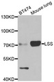 LSS Antibody - Western blot of extracts of various cell lines, using LSS antibody.