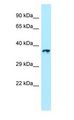 LTB4R2 / BLT2 Antibody - LTB4R2 / BLT2 antibody Western Blot of 721_B.  This image was taken for the unconjugated form of this product. Other forms have not been tested.