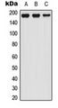 LTBP1 / LTBP-1 Antibody - Western blot analysis of LTBP1 expression in HEK293T (A); Raw264.7 (B); H9C2 (C) whole cell lysates.