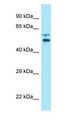LTV1 Antibody - LTV1 antibody Western Blot of Placenta.  This image was taken for the unconjugated form of this product. Other forms have not been tested.