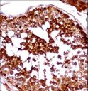 LW-1 / HSFX1 Antibody - HSFX1 Antibody immunohistochemistry of formalin-fixed and paraffin-embedded human testis tissue followed by peroxidase-conjugated secondary antibody and DAB staining.