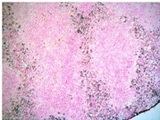 LY6C + LY6G Antibody - Staining for Ly-6G/-6C of frozen section of mouse spleen.  This image was taken for the unconjugated form of this product. Other forms have not been tested.
