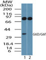 LY6G6F Antibody - Western blot of G6D in human platelet lysate in the 1) absence and 2) presence of immunizing peptide using Polyclonal Antibody to G6D at 1.0 ug/ml. Goat anti-rabbit Ig HRP secondary antibody, and PicoTect ECL substrate solution, were used for this test.
