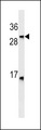 Lymphotoxin-Beta / LTB Antibody - LTB Antibody western blot of HL-60 cell line lysates (35 ug/lane). The LTB antibody detected the LTB protein (arrow).