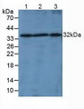 Lymphotoxin-Beta / LTB Antibody - Western Blot; Lane1: Mouse Liver Tissue; Lane2: Mouse Spleen Tissue; Lane3: Mouse Thymus Tissue.