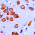 Lymphotoxin-Beta / LTB Antibody - Immunohistochemical analysis of LT beta staining in human brain formalin fixed paraffin embedded tissue section. The section was pre-treated using heat mediated antigen retrieval with sodium citrate buffer (pH 6.0). The section was then incubated with the antibody at room temperature and detected using an HRP conjugated compact polymer system. DAB was used as the chromogen. The section was then counterstained with hematoxylin and mounted with DPX.