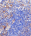 LYN Antibody - Immunohistochemical of paraffin-embedded M.spleen section using Mouse Lyn Antibody. NA was diluted at 1:25 dilution. A peroxidase-conjugated goat anti-rabbit IgG at 1:400 dilution was used as the secondary antibody, followed by DAB staining.