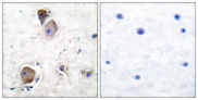 LYN Antibody - Immunohistochemistry analysis of paraffin-embedded human brain, using Lyn (Phospho-Tyr507) Antibody. The picture on the right is blocked with the phospho peptide.