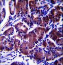 LYPLAL1 Antibody - LYPL1 Antibody immunohistochemistry of formalin-fixed and paraffin-embedded human stomach tissue followed by peroxidase-conjugated secondary antibody and DAB staining.