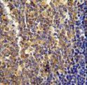 LYRM4 Antibody - LYRM4 antibody immunohistochemistry of formalin-fixed and paraffin-embedded human tonsil tissue followed by peroxidase-conjugated secondary antibody and DAB staining.