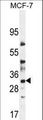 LYSMD4 Antibody - LYSMD4 Antibody western blot of MCF-7 cell line lysates (35 ug/lane). The LYSMD4 antibody detected the LYSMD4 protein (arrow).