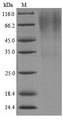 Lys-C Protein - (Tris-Glycine gel) Discontinuous SDS-PAGE (reduced) with 5% enrichment gel and 15% separation gel.The reducing (R) protein migrates as 75 kDa in SDS-PAGE may be due to glycosylation.