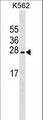 LZIC Antibody - LZIC Antibody western blot of K562 cell line lysates (35 ug/lane). The LZIC antibody detected the LZIC protein (arrow).