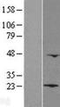 LZIC Protein - Western validation with an anti-DDK antibody * L: Control HEK293 lysate R: Over-expression lysate