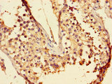 LZTFL1 Antibody - Immunohistochemistry of paraffin-embedded human testicular tissue using LZTFL1 Antibody at dilution of 1:100